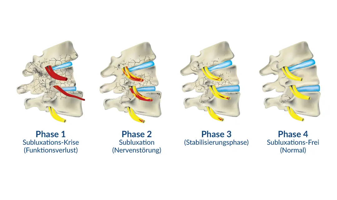 Chiropraktik - Die vier Phansen Heilung