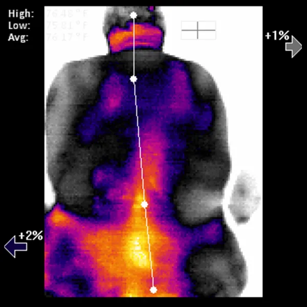 Chiropraktik Wirbelsäulen Thermal-Scan
