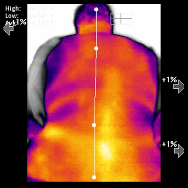 Chiropraktik Wirbelsäulen Thermal-Scan