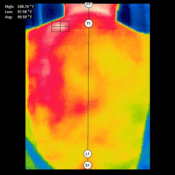 Chiropraktik Wirbelsäulen Thermal-Scan