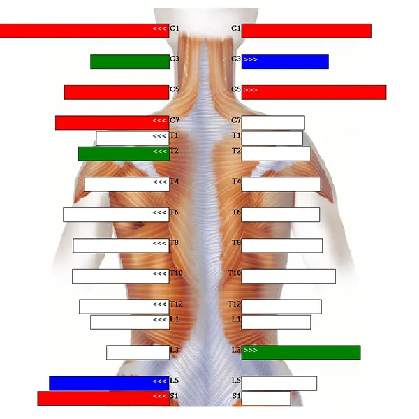Chiropraktik Wirbelsäulen Thermal-Scan
