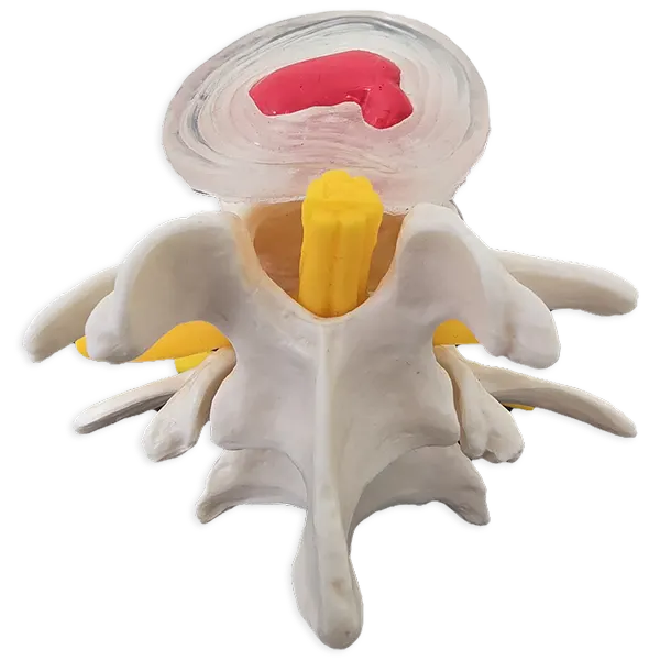 Bandscheiben-Therapie / Flexion-Distraction nach Cox - Phase 2