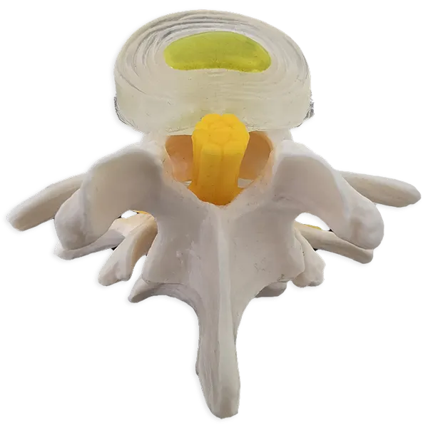 Bandscheiben-Therapie / Flexion-Distraction nach Cox - Phase 3